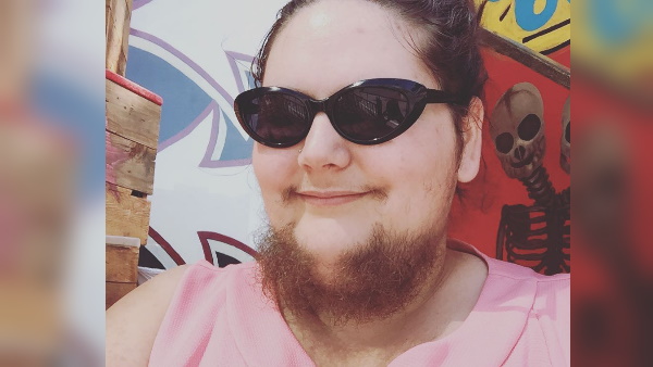 इस वजह से चेहरे पर निकल आई दाढ़ी