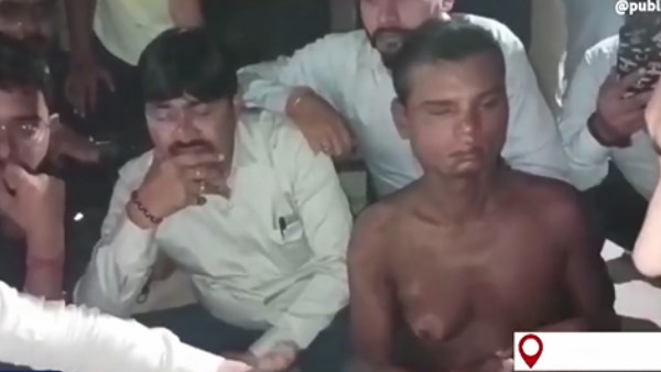 आँखों में डाला घातक पदार्थ