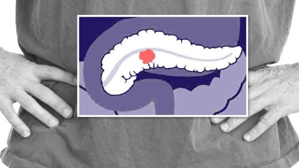कोरोना के दौरान कैंसर के 15 लाख मामले