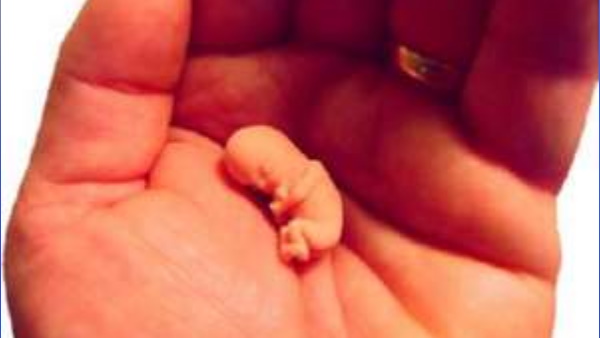 पैदा होते ही बना डाला यह विश्‍व रिकॉर्ड