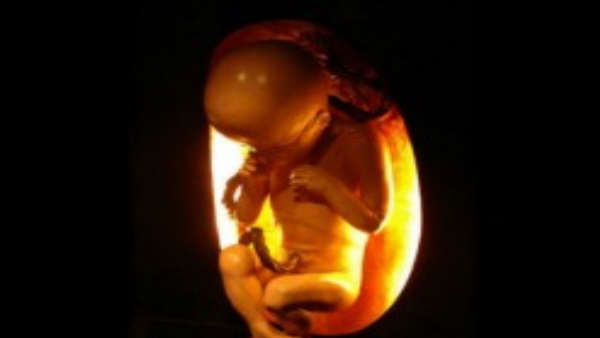 जानिए इस दंपत्ति ने क्‍यों चुना ये भ्रूण 