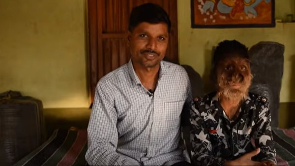 ये है बीमारी