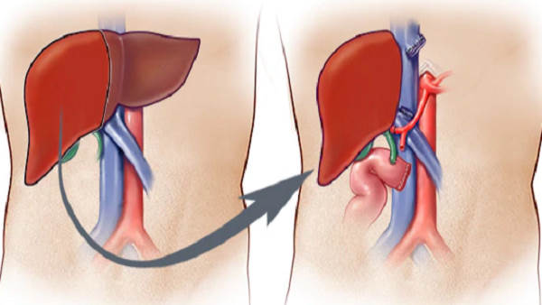 लड़की ने 18 वर्ष की निचली आयु सीमा से छूट मांगी है लड़की ने 18 वर्ष की निचली आयु सीमा से छूट मांगी है