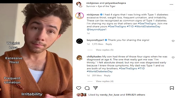 निक ने बताया अपना अनुभव