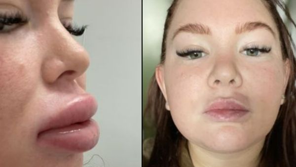 फिलिंग को बीत थे 6 महीने