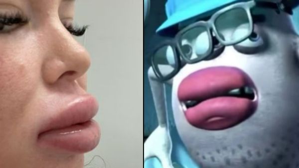 होंठो को हो गया बुरा हाल