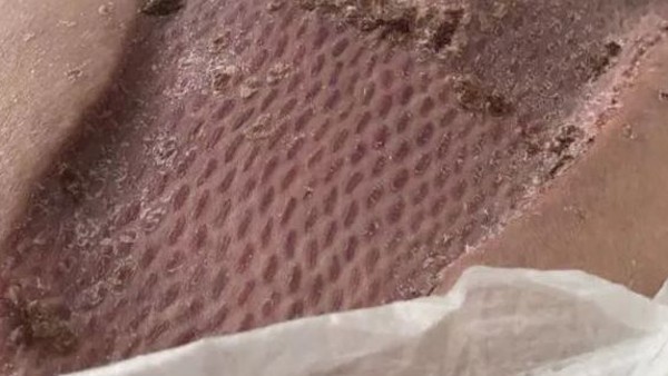 लोगों को दी ये सलाह