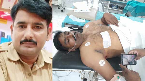 अस्पताल में ऑपरेशन कर निकाली गई गोली