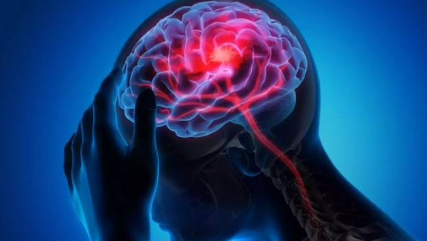 ब्रेन स्ट्रोक के संकेत