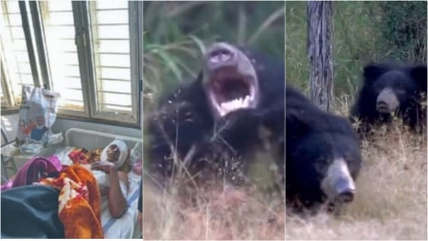 Bhalu ke hamle me kisan Ghayal Bhalu ke hamle me kisan Ghayal