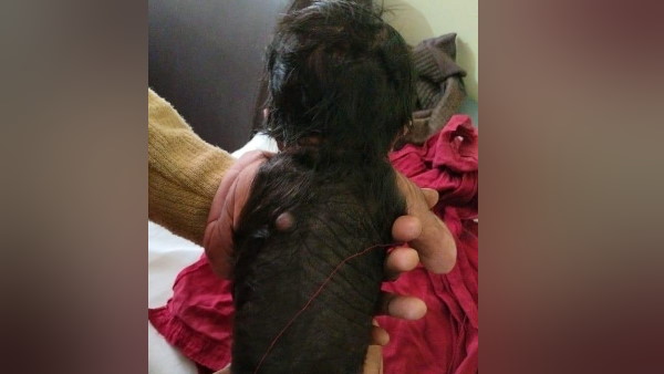 डॉक्टर ने कहा - पहले बार देखा ऐसा केस