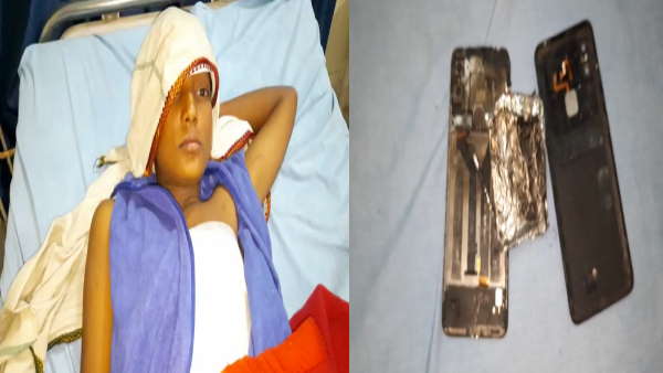 गेम खलेते वक्त फटा मोबाइल, किशोर घायल