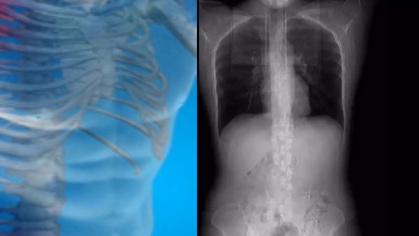 हुआंग की स्किल के ऊपर से नजर आती हैं पसलिया 