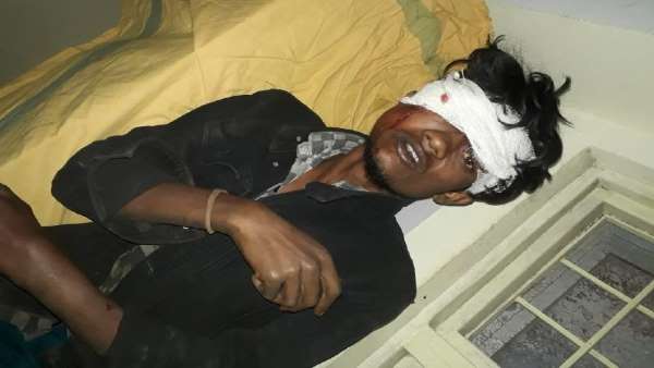 road Accident Cg road Accident Cg