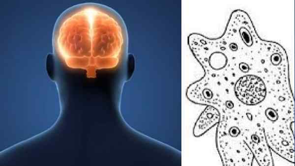 इलाज के दौरान मरीज ने दम तोड़ा