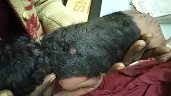 इलाज के लिए लखनऊ भेजा जाएगा बच्चा