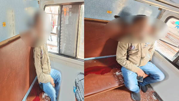 यात्री के सिर के आर-पार हुई रॉड