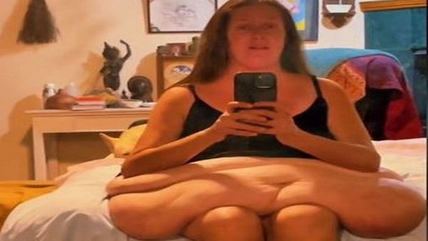 टेरेसा अपनी सर्जरी को लेकर हैं खुश टेरेसा अपनी सर्जरी को लेकर हैं खुश