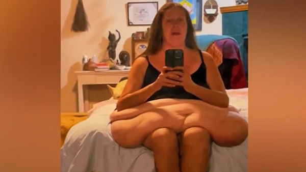 रोते हुए टेरेसा बोलीं- मेरा वजन 272 किलो था... रोते हुए टेरेसा बोलीं- मेरा वजन 272 किलो था...