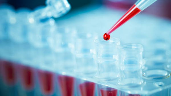 सबसे महत्वपूर्ण होता है ये एविडेंस सबसे महत्वपूर्ण होता है ये एविडेंस