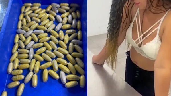 महिला ने निगल लिए थे 82 कैप्सूल