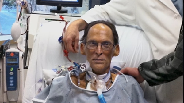 ना शरीर में था दिल और ना ही चल रही थी पल्‍स फिर था जिंदा 