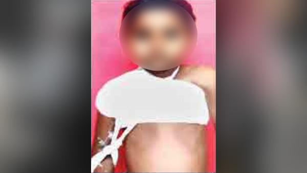 घायल बेटे को लेकर परेसान है पिता