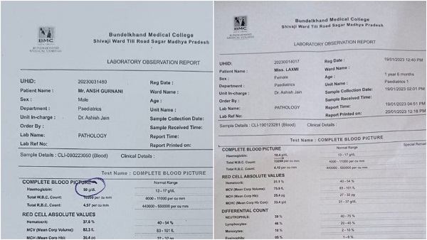 50 हीमोग्लोबिन की रिपोर्ट