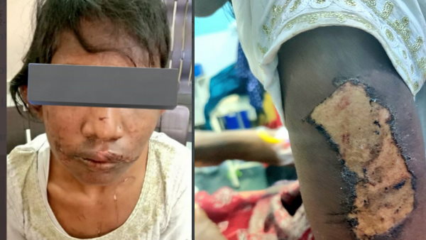 नहीं देते थे खाना, कूड़ेदान से बचा हुआ खाना खाती थी