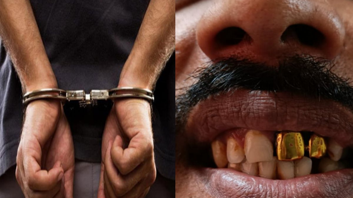Man caught with gold tooth Man caught with gold tooth
