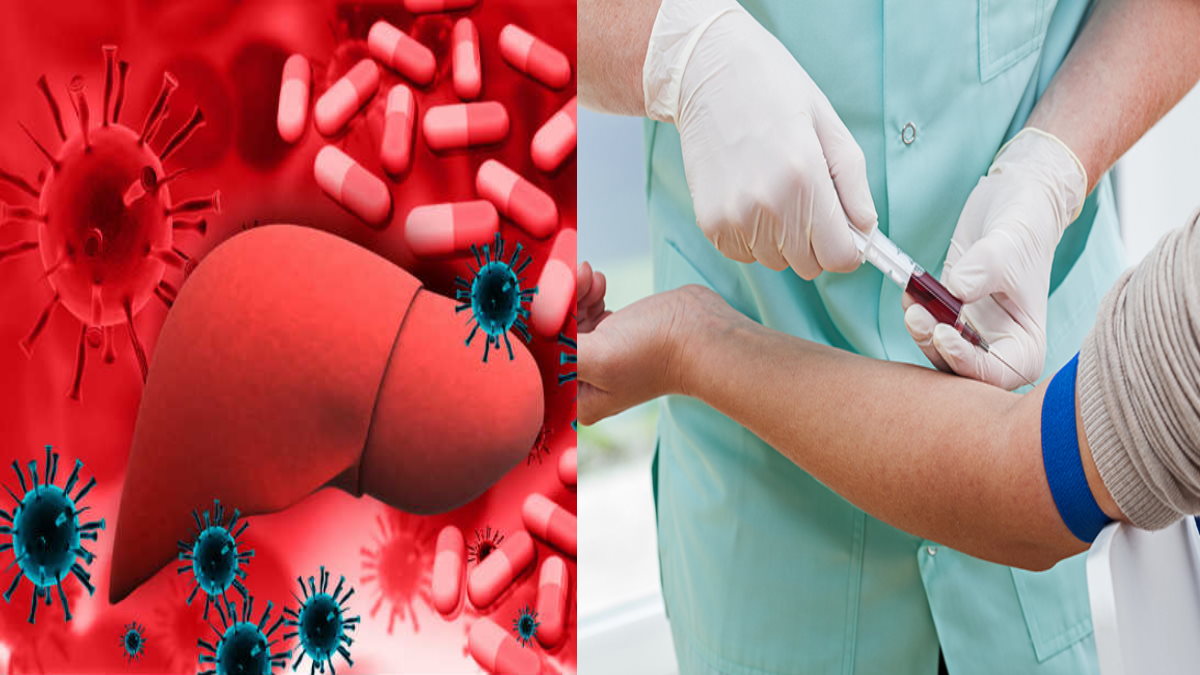 hepatitis checkup 