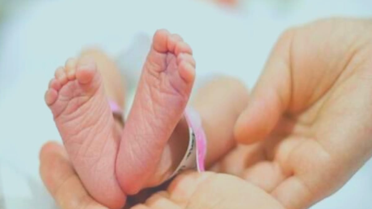 Shahdol girl was burnt with hot rods Shahdol girl was burnt with hot rods