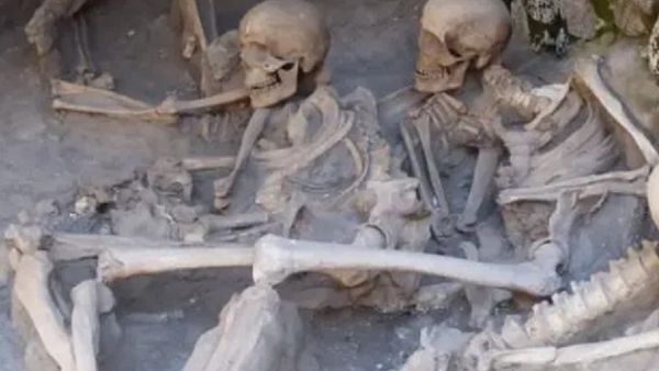 तीन हजार साल पहले सर्जरी