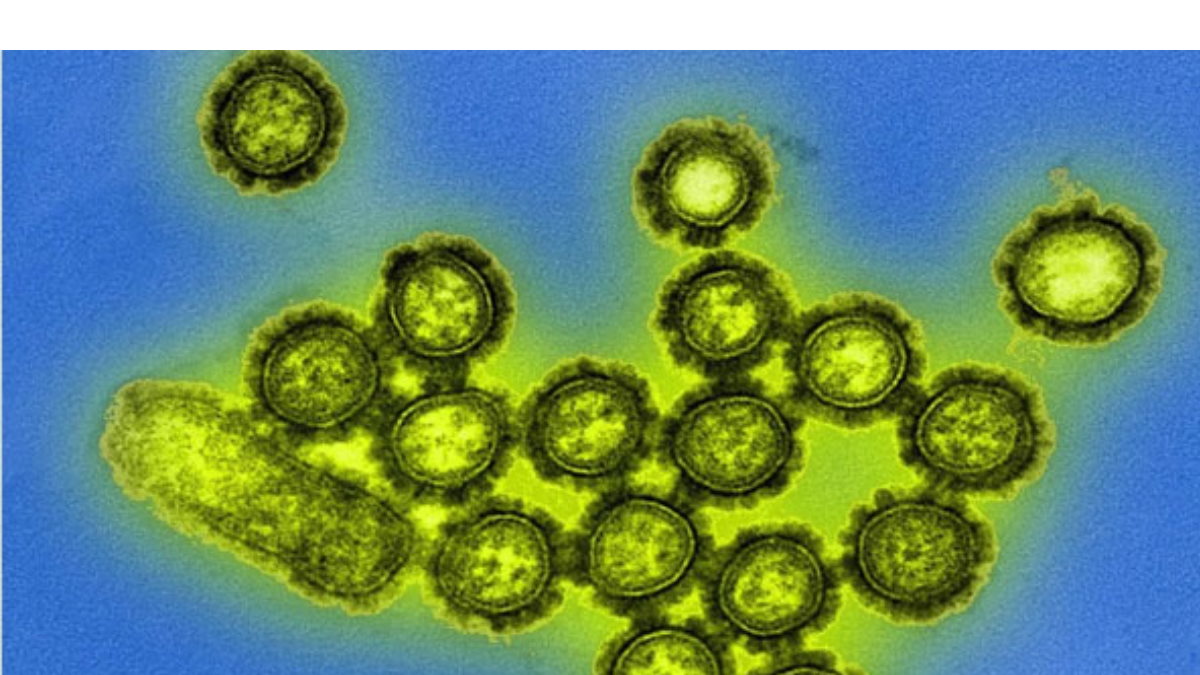 H3N2 virus H3N2 virus