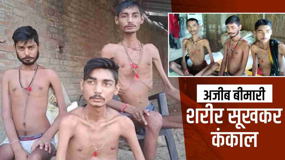 Rewa Muscular Dystrophy