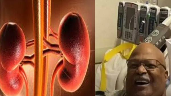 किडनी ट्रांसप्‍लांट की वजह से शख्‍स की बची जान 