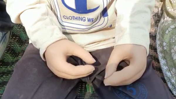 rampur Waseem got new imported censored hands from America with help of district administration rampur Waseem got new imported censored hands from America with help of district administration