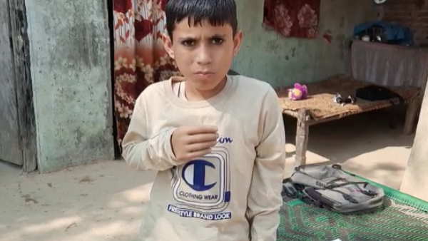 rampur Waseem got new imported censored hands from America with help of district administration rampur Waseem got new imported censored hands from America with help of district administration