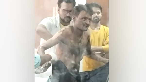 Lucknow Youth sets himself on fire in front of CM residence MLA Bamba Lal accused of harassing him
