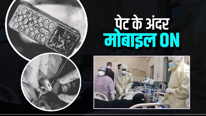 Bhai se jhagada hua to bahan ne mobile nigal liya Bhai se jhagada hua to bahan ne mobile nigal liya