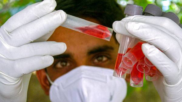 Antibody detected effective against corona virus, will work against different variants of Omicron from original variant of virus-study