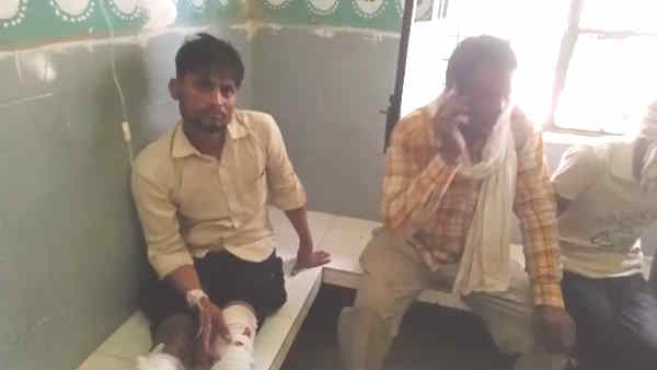 Balrampur 5 people injured in attack of leopard 3 days ago this leopard killed 7 year old girl 