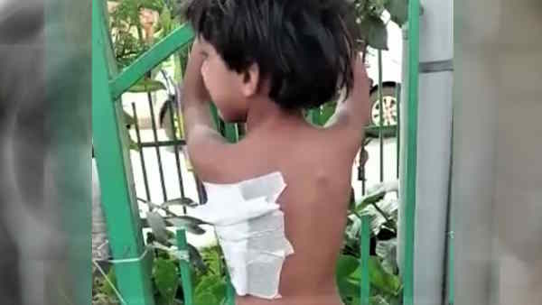 Pitbull dog attack terror once again in Lucknow, 2-year-old igirl attacked by dangerous dog 