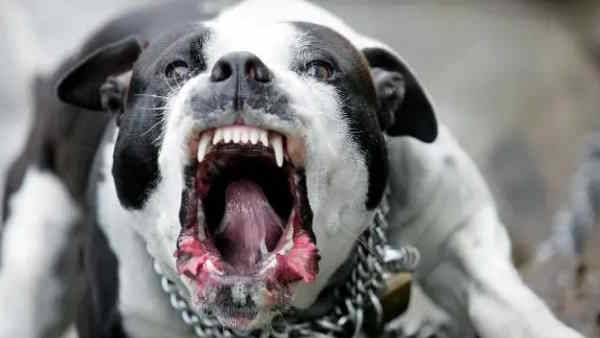 Pitbull dog attack terror once again in Lucknow, 2-year-old igirl attacked by dangerous dog 