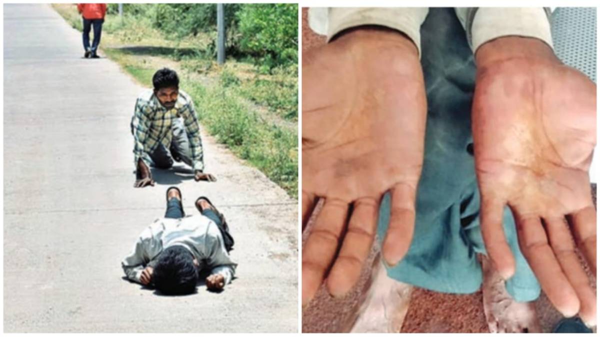 Farmers reached collectorate while filling their bodies blisters on hands in Khajuri of Shamshabad Farmers reached collectorate while filling their bodies blisters on hands in Khajuri of Shamshabad