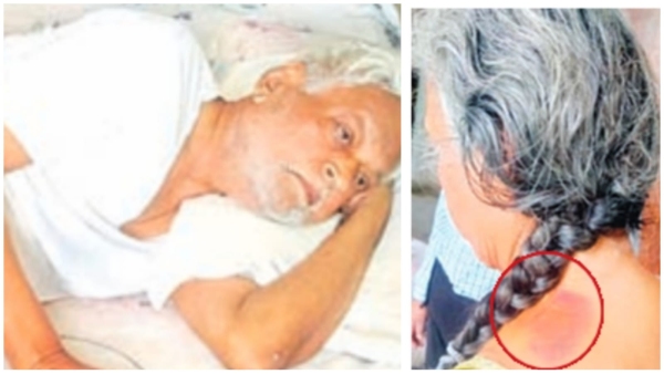 Parents were starving in Arera Colony, daughter held hostage and asked for Rs 3 crore