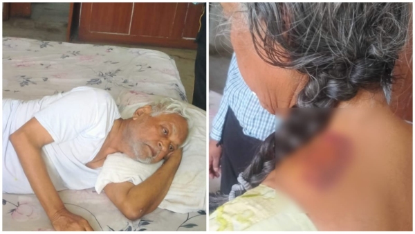 Tortured by daughter, old parents had full meal today, investigation of Habibganj Arera Hills police Tortured by daughter, old parents had full meal today, investigation of Habibganj Arera Hills police