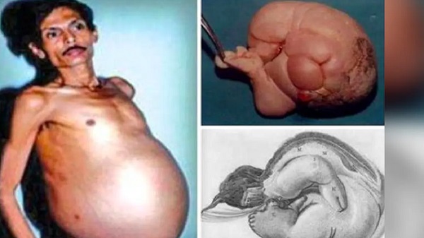 Nagpur-pregnant-man-sanju-bhagat Nagpur-pregnant-man-sanju-bhagat