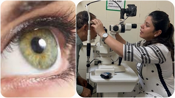 आईफ्लू: मौसम का रेड अटैक आंखे हो रही लाल, खून भी उतर रहा