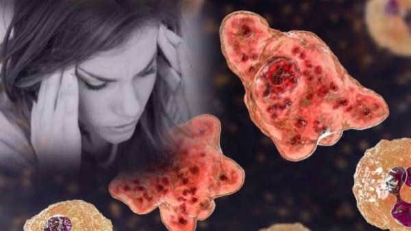 What is brain eating amoeba know its symptoms and treatment in hindi What is brain eating amoeba know its symptoms and treatment in hindi